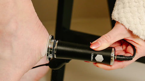 Eelt verwijderen: alles wat je moet weten